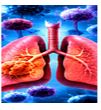 Respiratory Infections